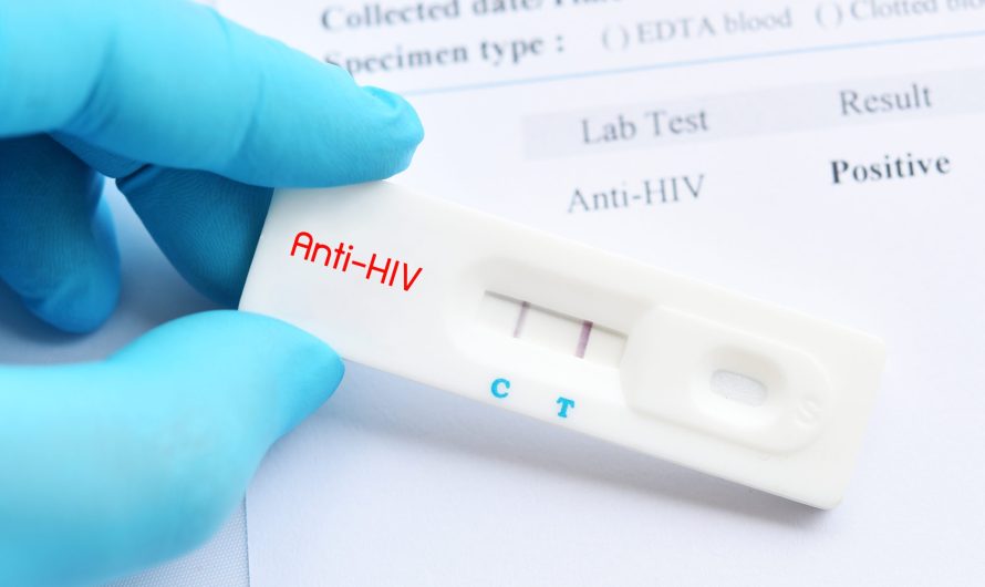 Asia Pacific HIV Diagnostics Market Is Estimated To Witness High Growth Owing To Increasing Awareness Regarding Early Diagnosis