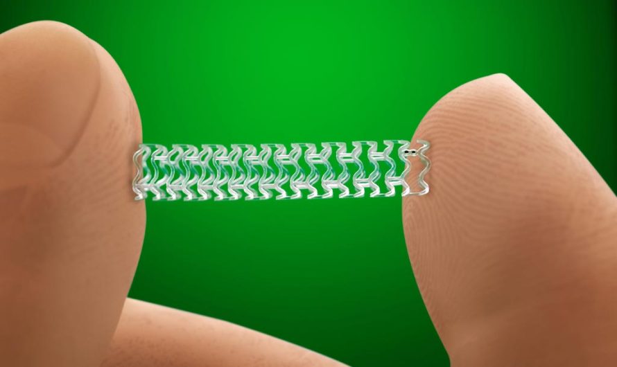 Global Bioresorbable Implants Market Is Estimated To Witness High Growth Owing To Technological Advancements