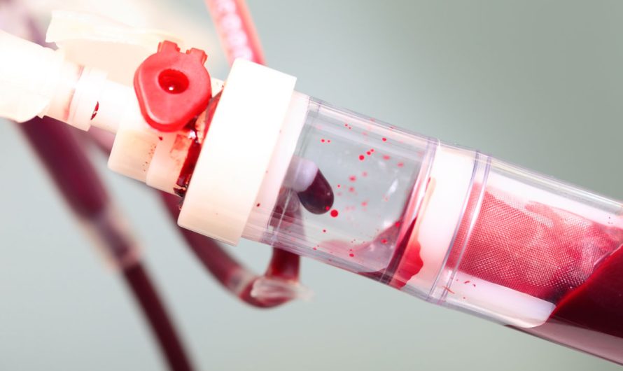 Global Blood Based Biomarker Market Is Estimated To Witness High Growth Owing To Increasing Prevalence of Chronic Diseases