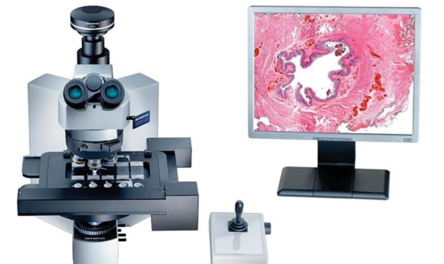 Digital Microscopes Market Is Estimated To Witness High Growth Owing To Advancements in Technology and Increasing Research and Development Activities