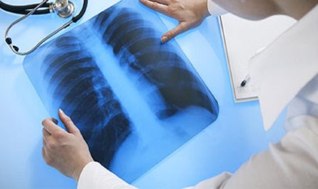 Lung Cancer Diagnostic and Screening Market