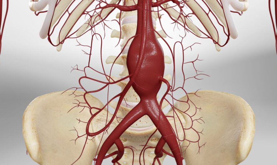 Unveiling the Hidden Dangers: Unstable “Fluttering” Predicts Aortic Aneurysm with 98% Accuracy