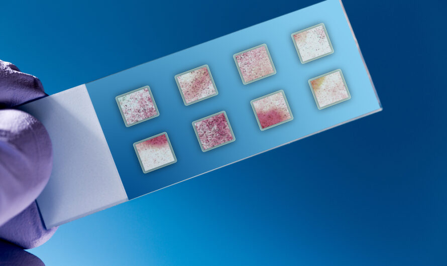 The Global Lab-On-A-Chip And Microarrays (Biochip) Market Is Estimated To Propelled By Increased Research And Development In Medical Diagnostic
