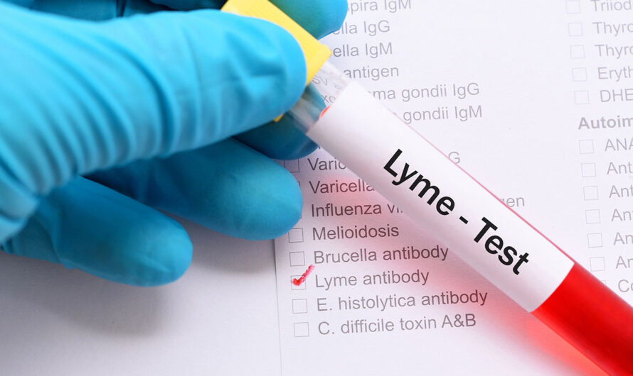 Lyme Disease Treatment Market Propelled by rising prevalence of Lyme disease