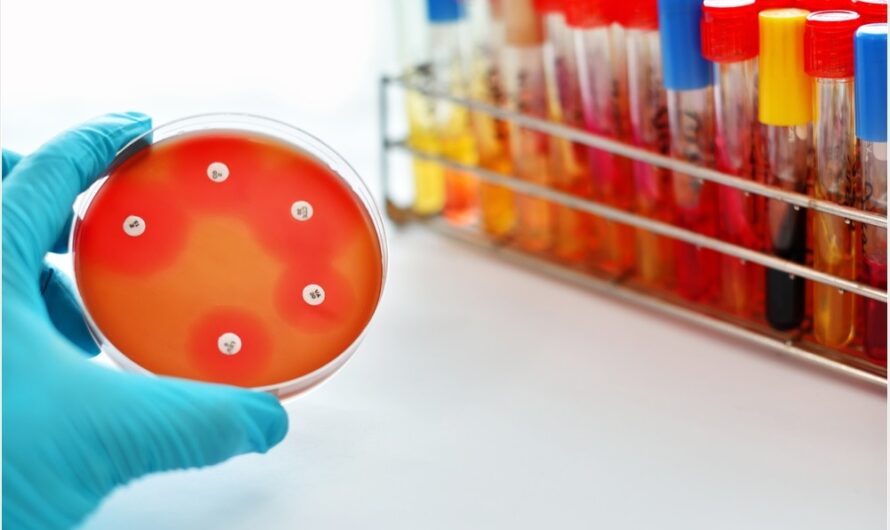 Antimicrobial Susceptibility Testing Market is Expected to Propelled by Rising Antibiotic Resistance