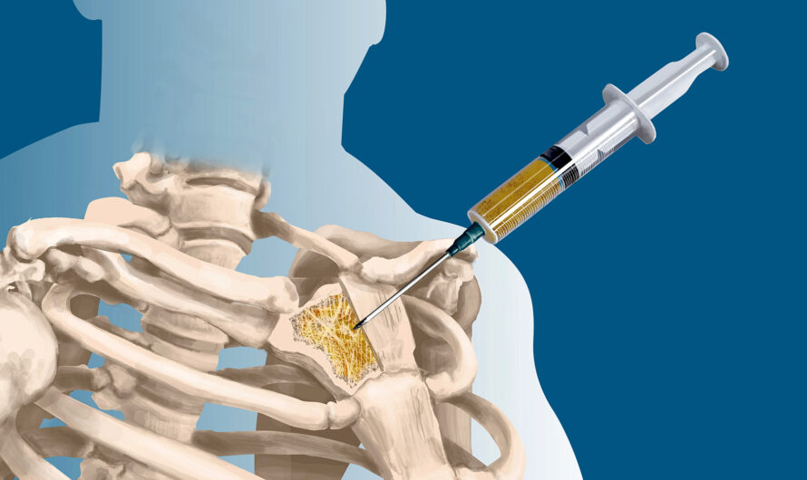 Cancer Biopsy Market Growth Driven By Rising Demand For Minimally Invasive Diagnostic Procedures