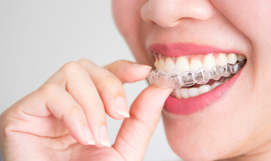The Global Orthodontics Market Is Driven By Rising Awareness Regarding Dental Aesthetics