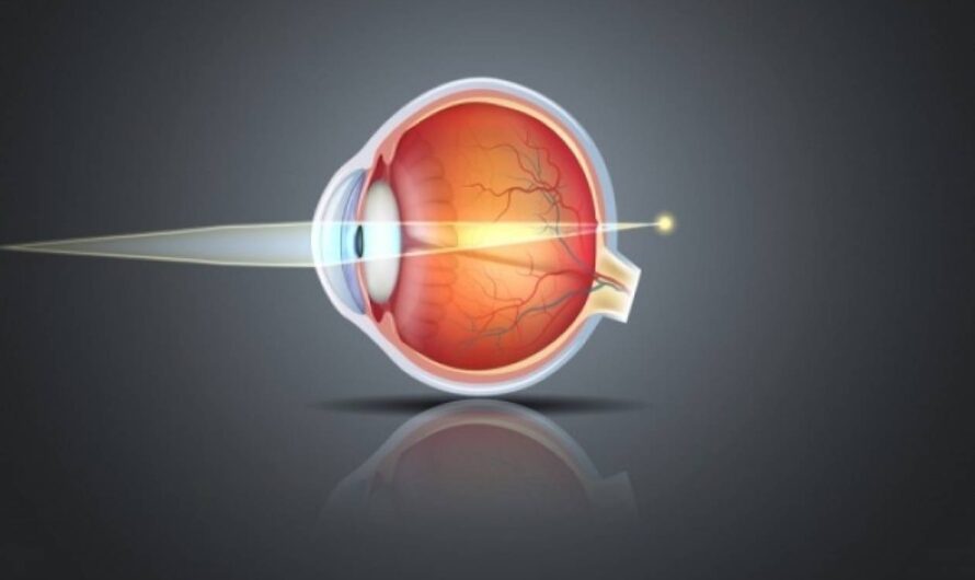 Eyesight Mastery: Effective Treatments for Myopia and Presbyopia