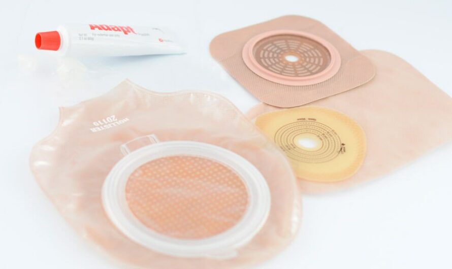 Ostomy Care Accessories: A Necessity For Effective Pouch Management
